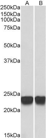 DJ-1 Antibody in Western Blot (WB)