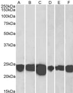 DJ-1 Antibody in Western Blot (WB)