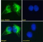 MURF2 Antibody in Immunocytochemistry (ICC/IF)