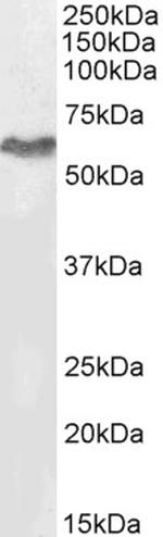 MURF2 Antibody in Western Blot (WB)