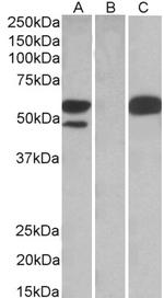 TRIM21 Antibody in Western Blot (WB)