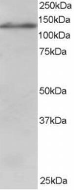 USP11 Antibody in Western Blot (WB)