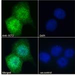 ECT2 Antibody in Immunocytochemistry (ICC/IF)