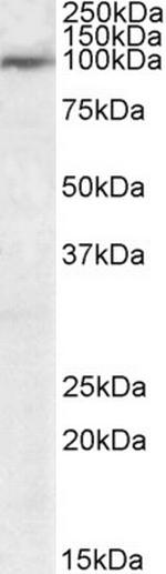 USP20 Antibody in Western Blot (WB)