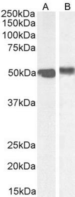 FOXA1 Antibody in Western Blot (WB)