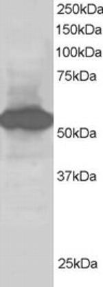 SIL1 Antibody in Western Blot (WB)