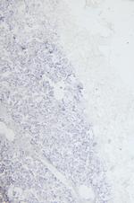 EPS8 Antibody in Immunohistochemistry (Paraffin) (IHC (P))