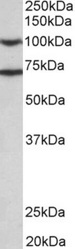 EPS8 Antibody in Western Blot (WB)