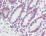 PTBP1 Antibody in Immunohistochemistry (Paraffin) (IHC (P))