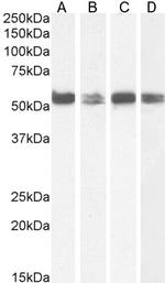 PTBP1 Antibody in Western Blot (WB)