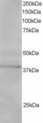 SAE1 Antibody in Western Blot (WB)