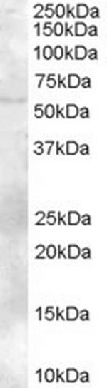 TZFP Antibody in Western Blot (WB)