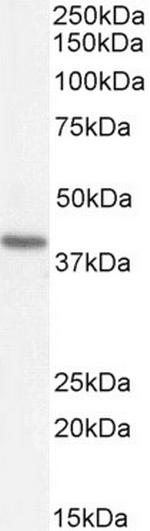 ATP6IP2 Antibody in Western Blot (WB)