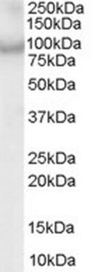 ACAP2 Antibody in Western Blot (WB)