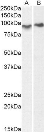 ACAP2 Antibody in Western Blot (WB)