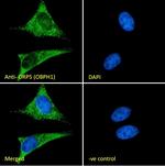 ORP5 Antibody in Immunocytochemistry (ICC/IF)