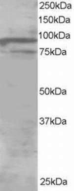 OSBPL11 Antibody in Western Blot (WB)