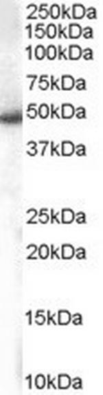 SNX5 Antibody in Western Blot (WB)