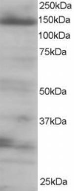 eIF4ENIF1 Antibody in Western Blot (WB)