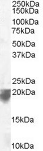 VPS29 Antibody in Western Blot (WB)