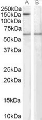 SIPA1 Antibody in Western Blot (WB)