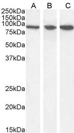 VPS35 Antibody in Western Blot (WB)