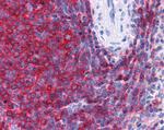 SH3BP1 Antibody in Immunohistochemistry (Paraffin) (IHC (P))