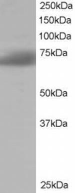 SH3BP1 Antibody in Western Blot (WB)