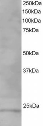 VPS28 Antibody in Western Blot (WB)