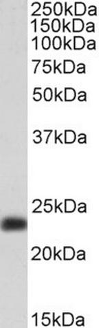 TAGLN Antibody in Western Blot (WB)