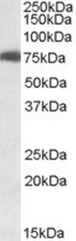 USH1C Antibody in Western Blot (WB)