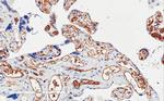 PIK3C2A Antibody in Immunohistochemistry (Paraffin) (IHC (P))