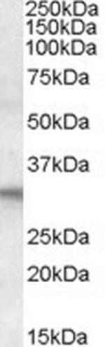 FHL2 Antibody in Western Blot (WB)