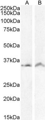 VDAC2 Antibody in Western Blot (WB)