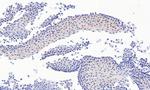 PAX3 Antibody in Immunohistochemistry (Paraffin) (IHC (P))