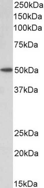 BAF53A/BAF53B Antibody in Western Blot (WB)