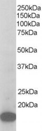 p21 ARC Antibody in Western Blot (WB)