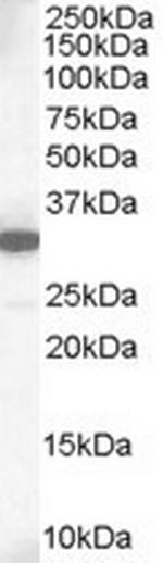 MCL-1 Antibody in Western Blot (WB)