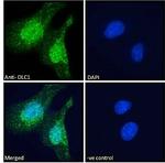 DLC1 Antibody in Immunocytochemistry (ICC/IF)