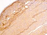 DLC1 Antibody in Immunohistochemistry (Paraffin) (IHC (P))