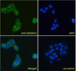 ADAM12 Antibody in Immunocytochemistry (ICC/IF)