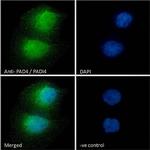 PADI4 Antibody in Immunocytochemistry (ICC/IF)