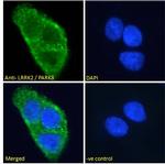 LRRK2 Antibody in Immunocytochemistry (ICC/IF)