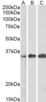 EFHD2 Antibody in Western Blot (WB)