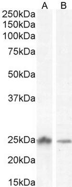 COMT Antibody in Western Blot (WB)