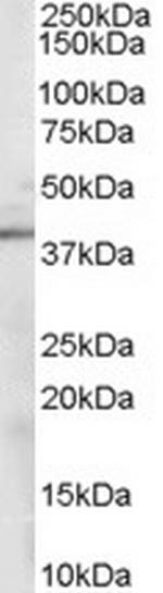 Sorbitol Dehydrogenase Antibody in Western Blot (WB)