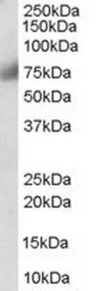 FGFR1 Antibody in Western Blot (WB)