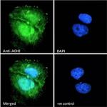 Acetylcholinesterase Antibody in Immunocytochemistry (ICC/IF)