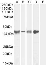 Asporin Antibody in Western Blot (WB)