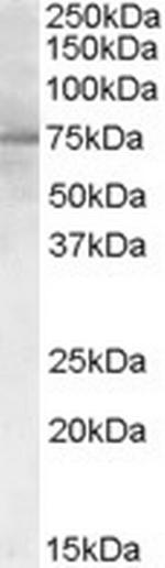 PCSK9 Antibody in Western Blot (WB)